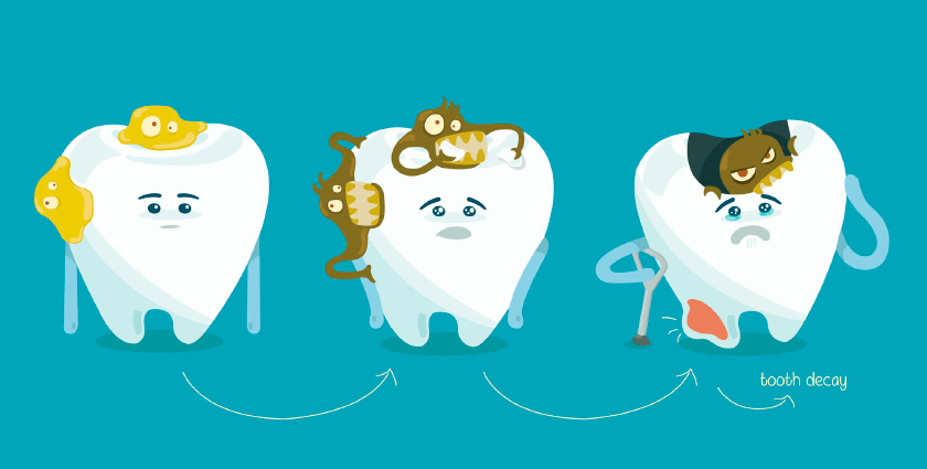 lam-rang-implant-mat-bao-nhieu-tien