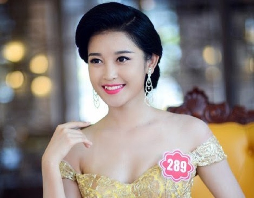 Tuổi thọ của răng Implant hay cắm implant được bao lâu là yếu tố quan trọng để bệnh nhân quyết định chọn lựa phương pháp này